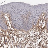 Anti-COL6A1 antibody produced in rabbit Prestige Antibodies&#174; Powered by Atlas Antibodies, affinity isolated antibody, buffered aqueous glycerol solution