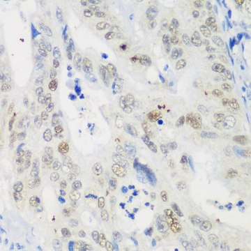Anti-p53 antibody produced in rabbit