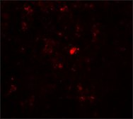 Anti-RBBP8 antibody produced in rabbit affinity isolated antibody, buffered aqueous solution