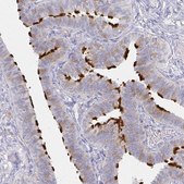 Anti-LRRC23 antibody produced in rabbit Prestige Antibodies&#174; Powered by Atlas Antibodies, affinity isolated antibody, buffered aqueous glycerol solution