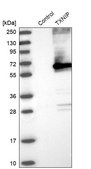 Anti-TXNIP antibody produced in rabbit Prestige Antibodies&#174; Powered by Atlas Antibodies, affinity isolated antibody, buffered aqueous glycerol solution