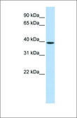 Anti-GNAO1 antibody produced in rabbit affinity isolated antibody