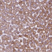 Anti-KMO antibody produced in rabbit Prestige Antibodies&#174; Powered by Atlas Antibodies, affinity isolated antibody, buffered aqueous glycerol solution