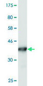 Monoclonal Anti-S100A10 antibody produced in mouse clone 3E10, purified immunoglobulin, buffered aqueous solution