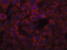 Anti-Actin (&#945;-Sarcomeric) antibody, Mouse monoclonal clone 5C5, hybridoma cell culture supernatant
