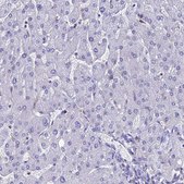 Anti-FGF7 antibody produced in rabbit Prestige Antibodies&#174; Powered by Atlas Antibodies, affinity isolated antibody, buffered aqueous glycerol solution