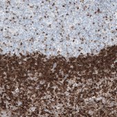 Monoclonal Anti-BCL2 antibody produced in mouse Prestige Antibodies® Powered by Atlas Antibodies, clone CL7935, purified immunoglobulin, buffered aqueous glycerol solution