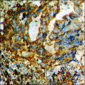 Anti-phospho-p53 (pSer37) antibody produced in rabbit affinity isolated antibody