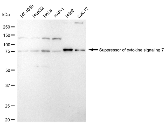 Anti Suppressor Of Cytokine Signaling 7 Antibody, clone 24GB1820, Rabbit Monoclonal clone 24GB1820, recombinant rabbit monoclonal, expressed in HEK293 cells
