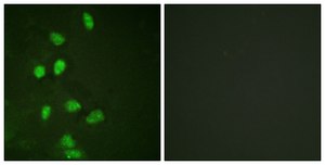 Anti-CHOP, N-Terminal antibody produced in rabbit affinity isolated antibody