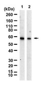 Anti-AMH/MIS Antibody, clone 2G11 ZooMAb&#174; Rabbit Monoclonal recombinant, expressed in HEK 293 cells