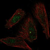 Anti-XDH antibody produced in rabbit Prestige Antibodies&#174; Powered by Atlas Antibodies, affinity isolated antibody