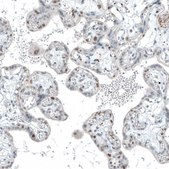Monoclonal Anti-TET2 antibody produced in mouse Prestige Antibodies&#174; Powered by Atlas Antibodies, clone CL6873, purified immunoglobulin, buffered aqueous glycerol solution