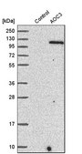 Anti-AOC3 antibody produced in rabbit Prestige Antibodies&#174; Powered by Atlas Antibodies, affinity isolated antibody, buffered aqueous glycerol solution