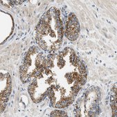 Anti-CAMKK2 antibody produced in rabbit Prestige Antibodies&#174; Powered by Atlas Antibodies, affinity isolated antibody, buffered aqueous glycerol solution