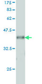 Monoclonal Anti-VAV1 antibody produced in mouse clone 9C1, purified immunoglobulin, buffered aqueous solution