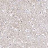 Anti-SYT1 antibody produced in rabbit Prestige Antibodies&#174; Powered by Atlas Antibodies, affinity isolated antibody, buffered aqueous glycerol solution