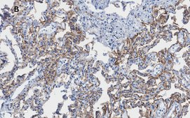 Anti-Integrin alpha V beta 6 Antibody, clone EM05201, ZooMAb® Rabbit Monoclonal recombinant, expressed in HEK 293 cells