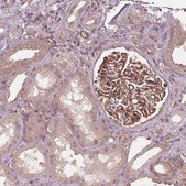 Anti-TXNIP antibody produced in rabbit Prestige Antibodies&#174; Powered by Atlas Antibodies, affinity isolated antibody, buffered aqueous glycerol solution