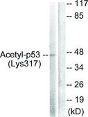 Anti-Acetyl (Lys 319) p53 Antibody, C-Terminal antibody produced in rabbit affinity isolated antibody