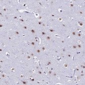 Anti-SRSF5 antibody produced in rabbit Prestige Antibodies&#174; Powered by Atlas Antibodies, affinity isolated antibody, buffered aqueous glycerol solution