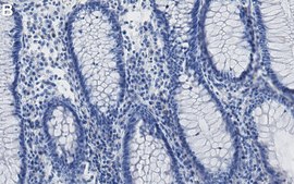 Anti-VPS35 Antibody, clone 1C7 ZooMAb&#174; Rabbit Monoclonal recombinant, expressed in HEK 293 cells
