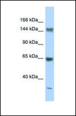 Anti-ATXN2 antibody produced in rabbit affinity isolated antibody