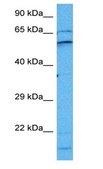 Anti-EPOR antibody produced in rabbit affinity isolated antibody