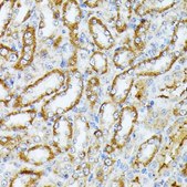 Anti-Caspase 1 antibody produced in rabbit