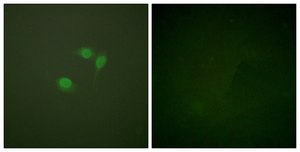 Anti-SUMO1, N-Terminal antibody produced in rabbit affinity isolated antibody