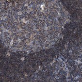 Anti-SMAP2 antibody produced in rabbit Prestige Antibodies&#174; Powered by Atlas Antibodies, affinity isolated antibody, buffered aqueous glycerol solution, Ab1