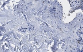 Anti-Collagen Type III Antibody, clone 3N18 ZooMAb® Rabbit Monoclonal recombinant, expressed in HEK 293 cells