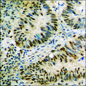Anti-phospho-CDC25A (pSer178) antibody produced in rabbit affinity isolated antibody