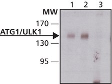 Anti-Atg1/ULK1 antibody produced in rabbit ~1&#160;mg/mL, affinity isolated antibody, buffered aqueous solution