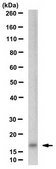 Anti-Haptoglobin Antibody, clone P2A12