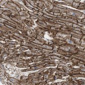 Anti-BVES antibody produced in rabbit Prestige Antibodies&#174; Powered by Atlas Antibodies, affinity isolated antibody, buffered aqueous glycerol solution