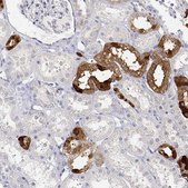 Anti-CALB1 antibody produced in rabbit Prestige Antibodies&#174; Powered by Atlas Antibodies, affinity isolated antibody, buffered aqueous glycerol solution