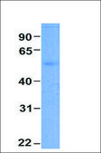 Anti-ESR2 antibody produced in rabbit affinity isolated antibody