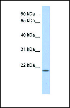 Anti-CHAC2, (N-terminal) antibody produced in rabbit affinity isolated antibody