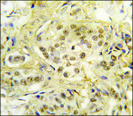 Anti-UBA2 (N-term) antibody produced in rabbit IgG fraction of antiserum, buffered aqueous solution