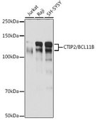 Anti-CTIP2/BCL11B antibody produced in rabbit