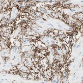 Anti-MFAP5 antibody produced in rabbit Prestige Antibodies&#174; Powered by Atlas Antibodies, affinity isolated antibody, buffered aqueous glycerol solution