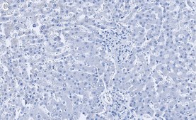 Anti-Catalase Antibody, clone 1C21 ZooMAb&#174; Rabbit Monoclonal recombinant, expressed in HEK 293 cells