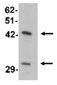 Anti-SEC62 Antibody from rabbit, purified by affinity chromatography