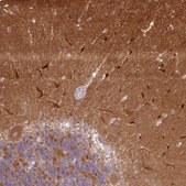 Anti-CAMK2A antibody produced in rabbit Prestige Antibodies® Powered by Atlas Antibodies, affinity isolated antibody, buffered aqueous glycerol solution