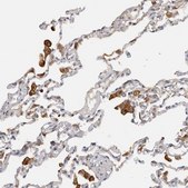 Anti-TFRC antibody produced in rabbit Prestige Antibodies&#174; Powered by Atlas Antibodies, affinity isolated antibody, buffered aqueous glycerol solution