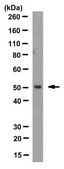 Anti-CYP51A1 Antibody, clone N6-P2H5*G8 clone N6-P2H5*G8, from mouse