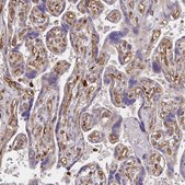 Anti-WASF2 antibody produced in rabbit Prestige Antibodies&#174; Powered by Atlas Antibodies, affinity isolated antibody, buffered aqueous glycerol solution