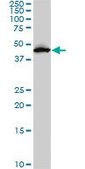 Monoclonal Anti-PDK2 antibody produced in mouse clone 5F8, purified immunoglobulin, buffered aqueous solution