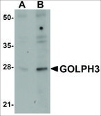 Anti-GOLPH3 antibody produced in rabbit affinity isolated antibody, buffered aqueous solution